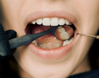 dental screening